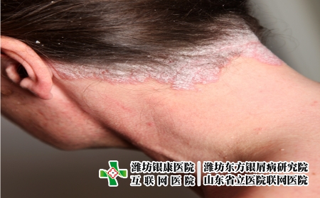 攝圖網_327944171_嚴重皮絲蟲病     頸部（企業商用）