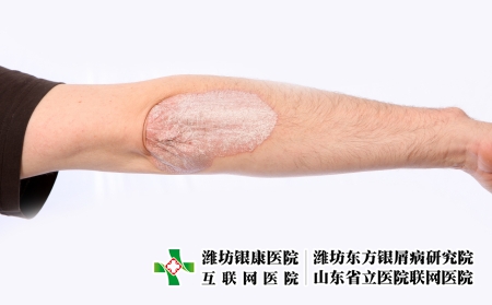 攝圖網_327921215_微絲蟲病藥物皮膚濕疹疾病人體皮疹皮炎痛苦燒傷醫(yī)生（企業(yè)商用）