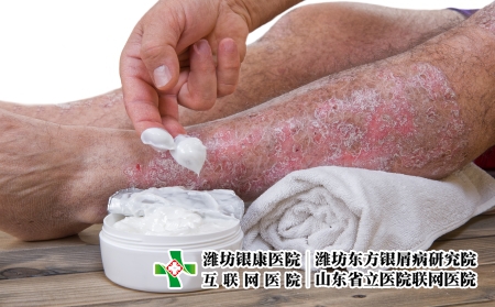 攝圖網_502709980_皮絲蟲病是皮膚慢發炎疾病（企業商用）