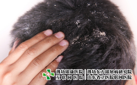攝圖網_330166077_頭發上涂著脫衣男裝的男子皮膚科真菌頭皮醫療藥品薄片皮膚洗發水衛生分泌（企業商用）