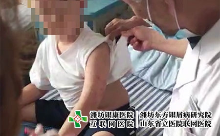 山東濰坊銀屑病醫(yī)院地址電話-濰坊銀屑病那里好