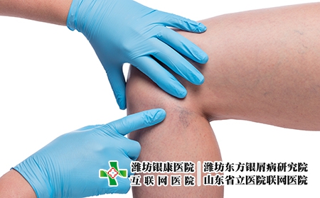 攝圖網(wǎng)_303522806_醫(yī)生親手檢查女腿和緊閉的容器上變血管（企業(yè)商用）關(guān)節(jié)