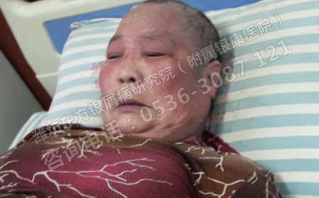 入院時局部皮膚情況
