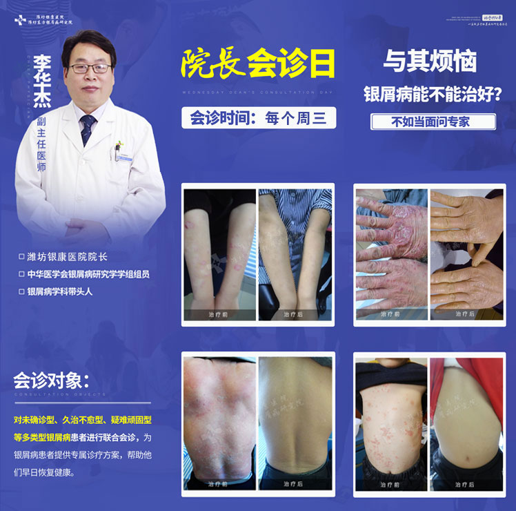 濰坊皮膚病醫院周三院長會診日